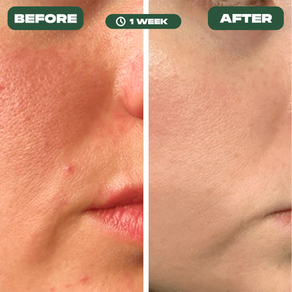 LioraGlow LED Face Mask